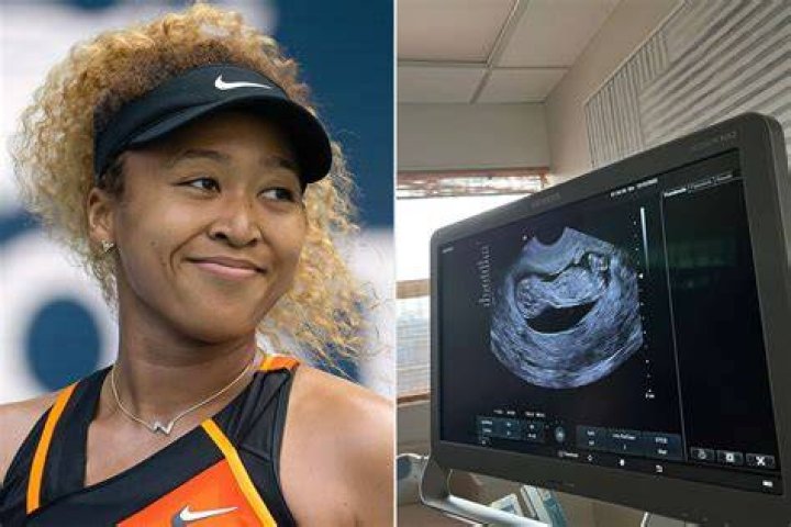 Pregnant Naomi Osaka Knows the Sex of Her Baby, Partner Cordae Doesn't
