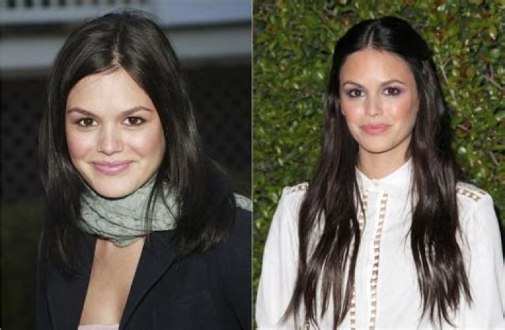 Rachel Bilson Plastic Surgery Before and After