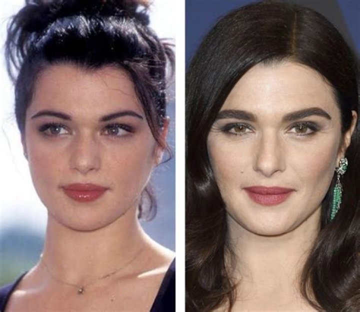 Rachel Weisz Plastic Surgery Comparison Photos