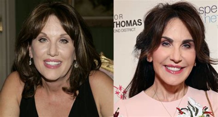 Robin McGraw cosmetic surgery rumours