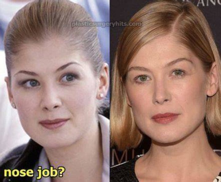 Rosamund Pike Nose Job Before And After Photos