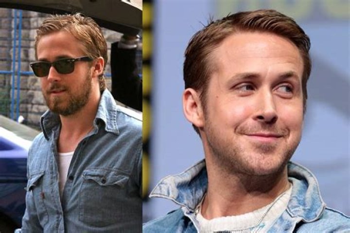 Ryan Gosling Plastic Surgery Before and After Pictures 2024