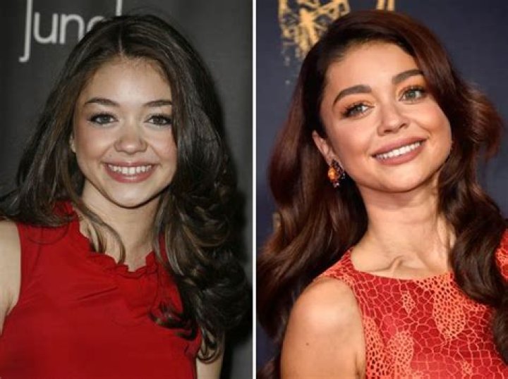 Sarah Hyland Nose job, Celebrities, Rhinoplasty