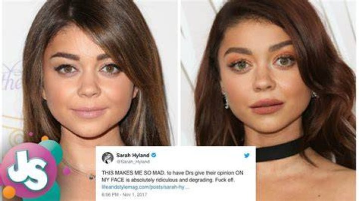 Sarah Hyland plastic surgery (01) Celebrity plastic surgery online