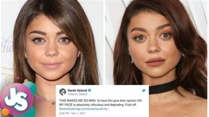 Sarah Hyland plastic surgery (13) Celebrity plastic surgery online