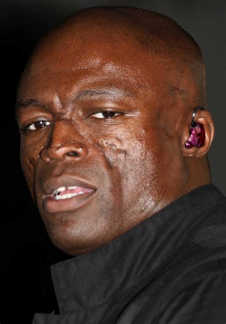 Seal Face Scars & Lupus What Happened To Seals Face DLE