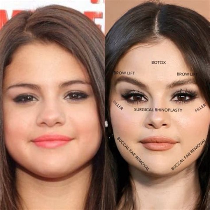 Selena Gomez, Before and After Celebrity makeup, Celebrity plastic