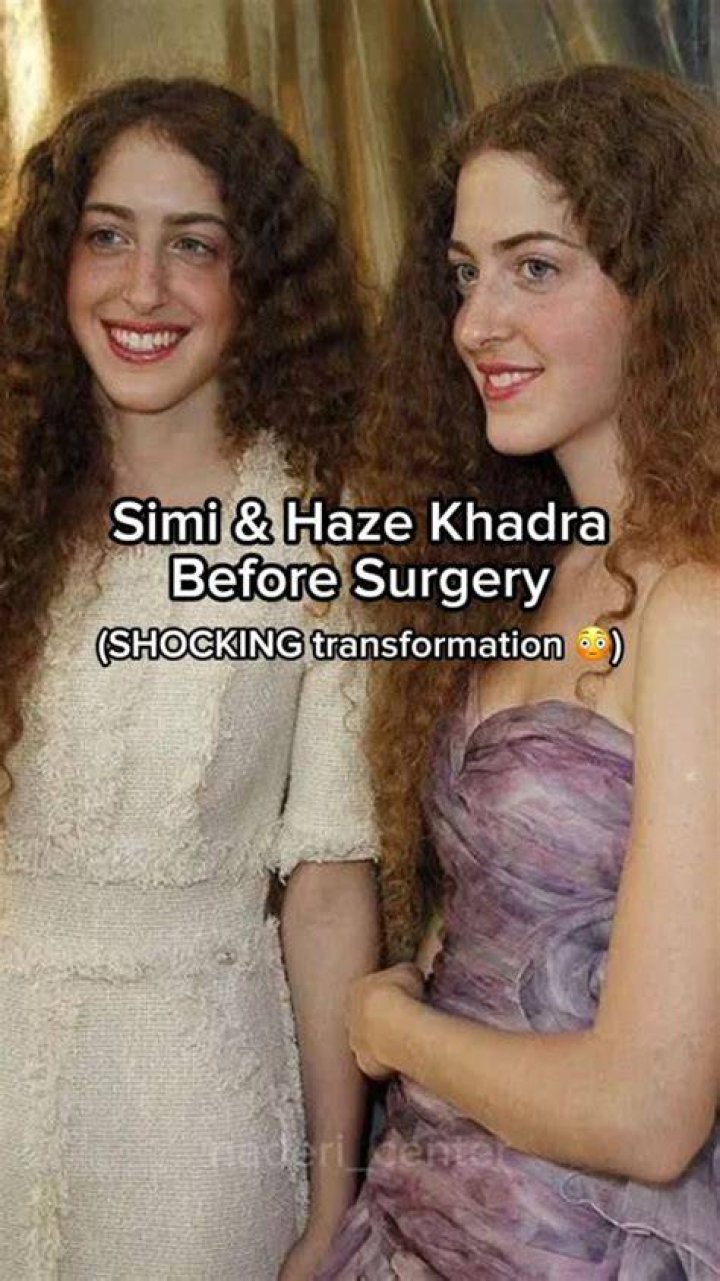 Simi And Haze Before And After Pictures Full Tranformation Journey!