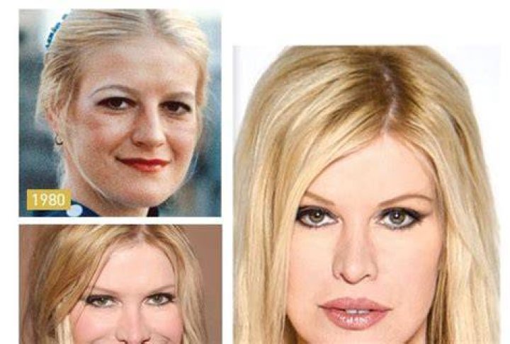 Sindi ima 64, a cilj joj je da izgleda PRIRODNO? Ona je REKORDERKA U