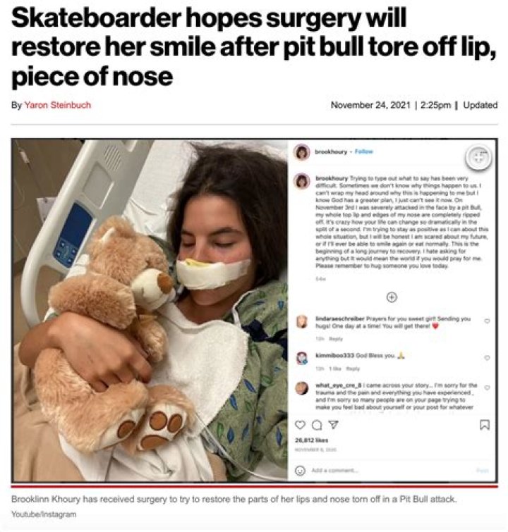 Skateboarder hopes surgery will restore her smile after pit bull tore