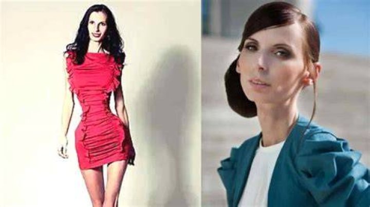 Skinniest Person 2021 Top 5 Skinniest People in the World