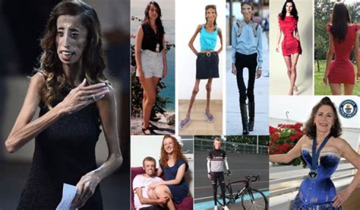 Skinniest Person Meet 10 World's Thinnest People Alive 2023 The