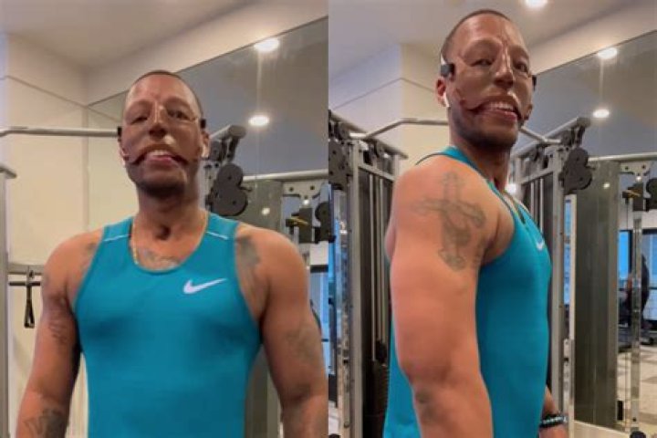 Soldier Randy Adams Before And After Photos