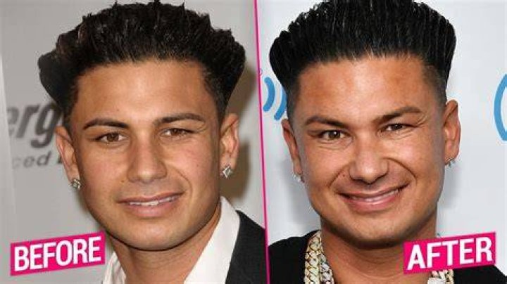 south jersey shore plastic surgery Tegan Curley