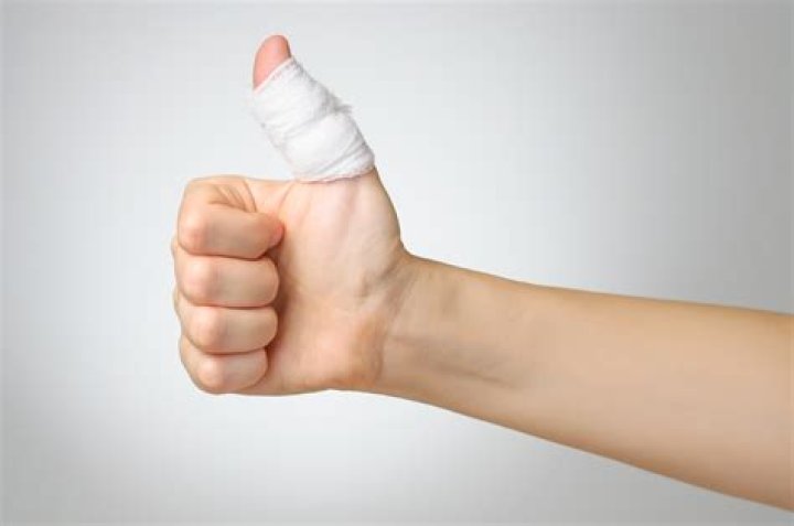 Sprained Thumb Cause and Recovery Time OrthoIndy Blog