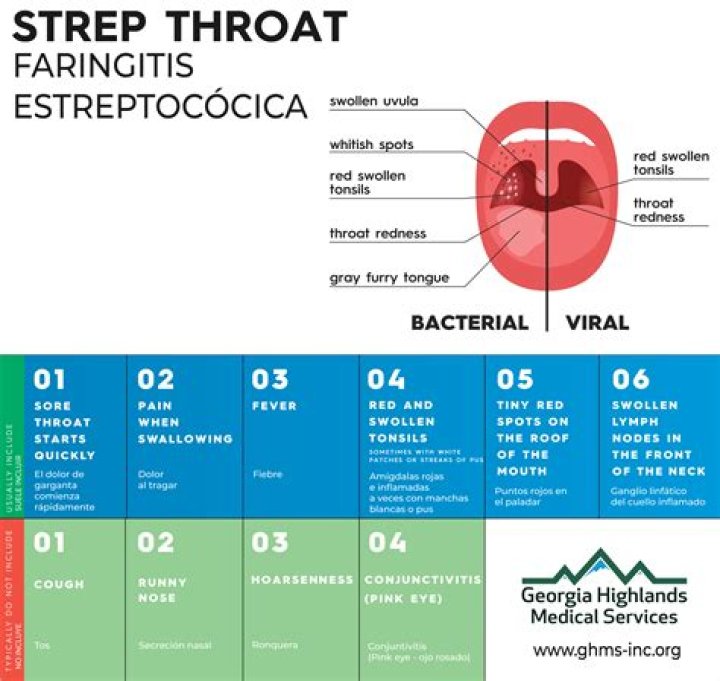 Strep Throat Symptoms, Causes, Diagnosis & Treatment