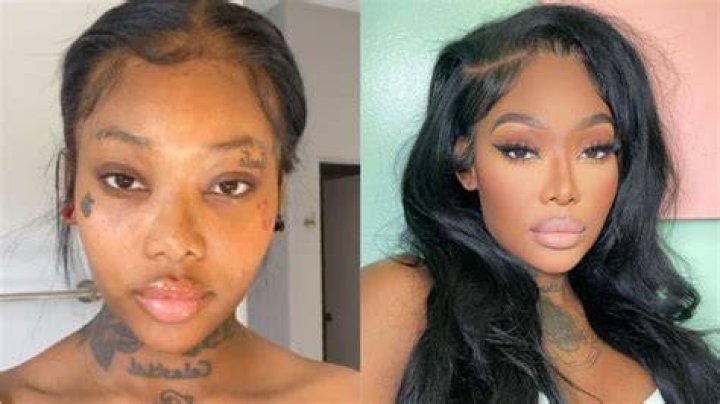Summer Walker Before Plastic Surgery New Look on BET Awards 2022?