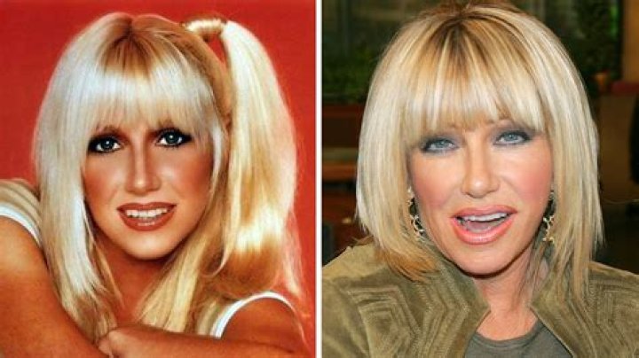 Suzanne Somers Plastic Surgery YouTube
