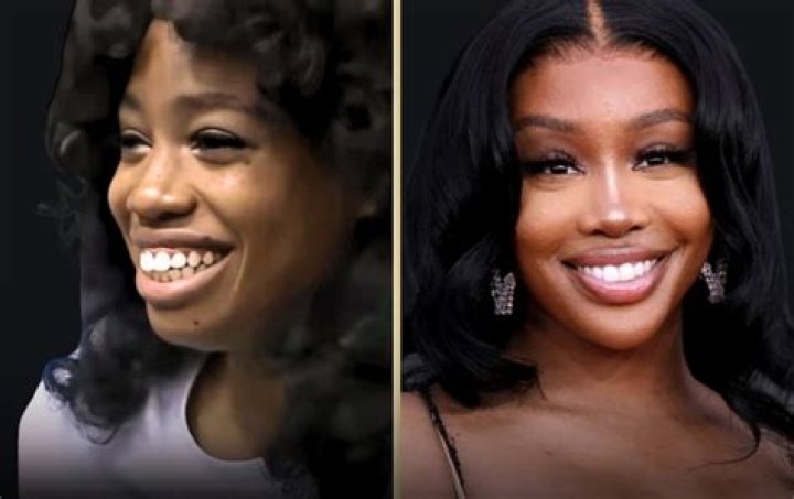 SZA Before Surgery See How Much She's Changed Over the Years