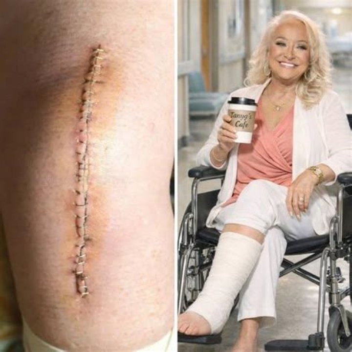 Tanya Tucker Opens Up About Depression 'My Music Saved Me' Closer Weekly