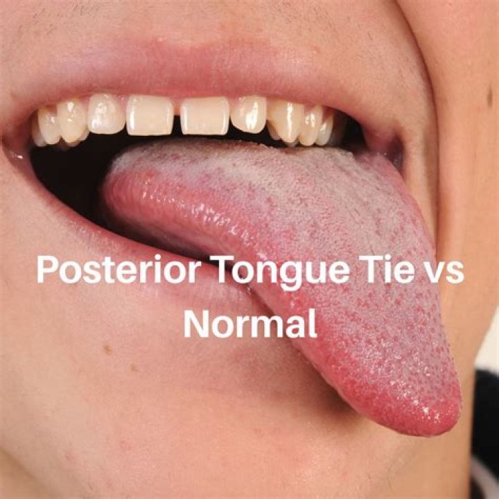 The Yor&ugrave;b&aacute; Tongue Tied
