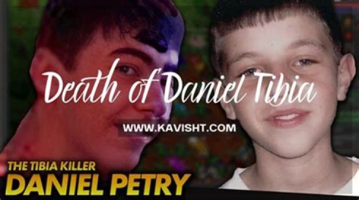 Tibia Case Daniel Photos An Notable Medical Case