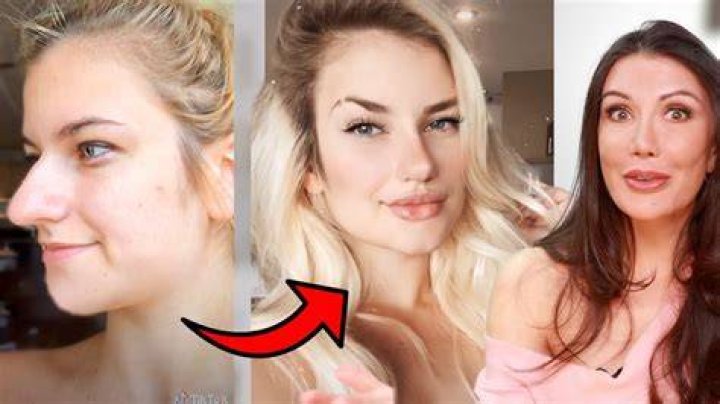 Tiktok Plastic Surgery Shocking Transformations Cl&iacute;nica de Nuevas