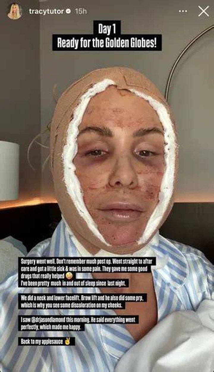 Tracy Tutor Responds to Plastic Surgery, Botox Claims The Daily Dish