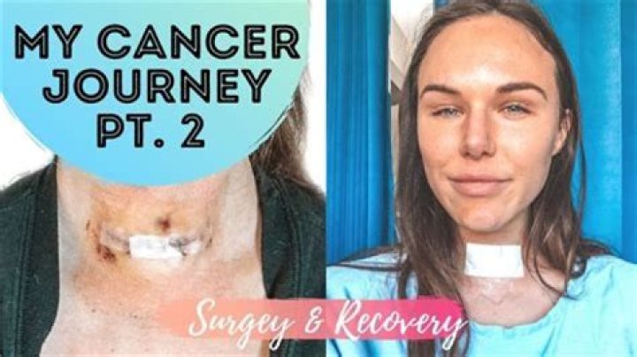 Unlock The Secrets Of Exceptional Thyroid Surgery With Joyce Vance