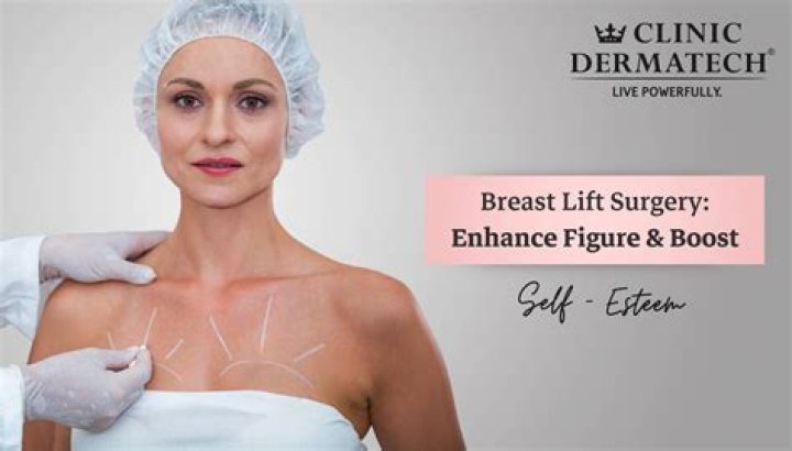 Unveiling Nicole Richie's Breast Augmentation Journey: Discoveries And Insights