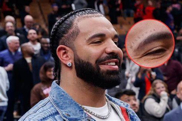 Unveiling The Hidden Meaning: Drake's Face Tattoo Decoded!