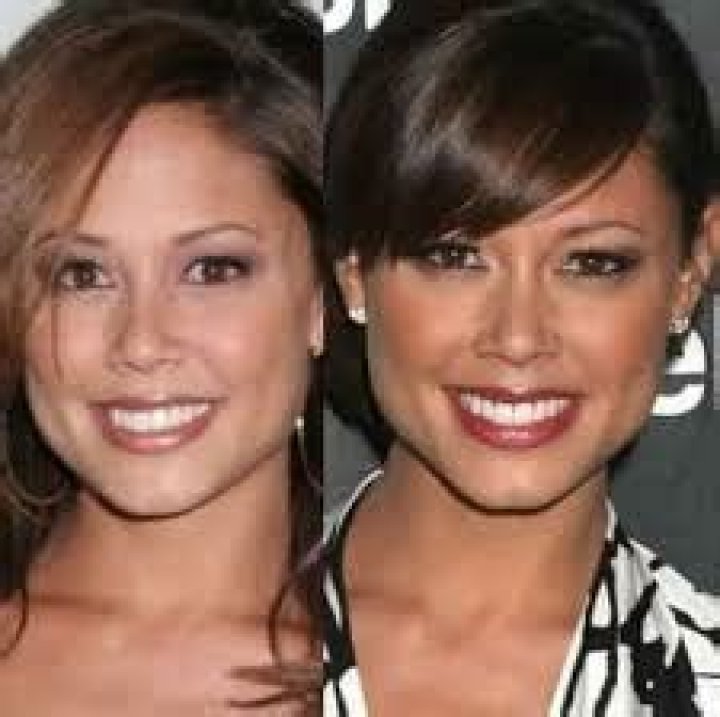 Vanessa Lachey Plastic Surgery Nose Job, Boob Job, Facelift, and More
