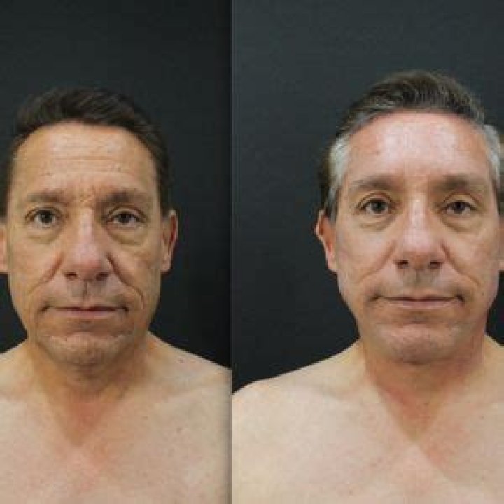 Vive Plastic Surgery Tijuana Reviews Plastic surgery, Tijuana, Surgery