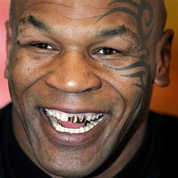 Wallpaper World Celebrities With Bad Teeth photo