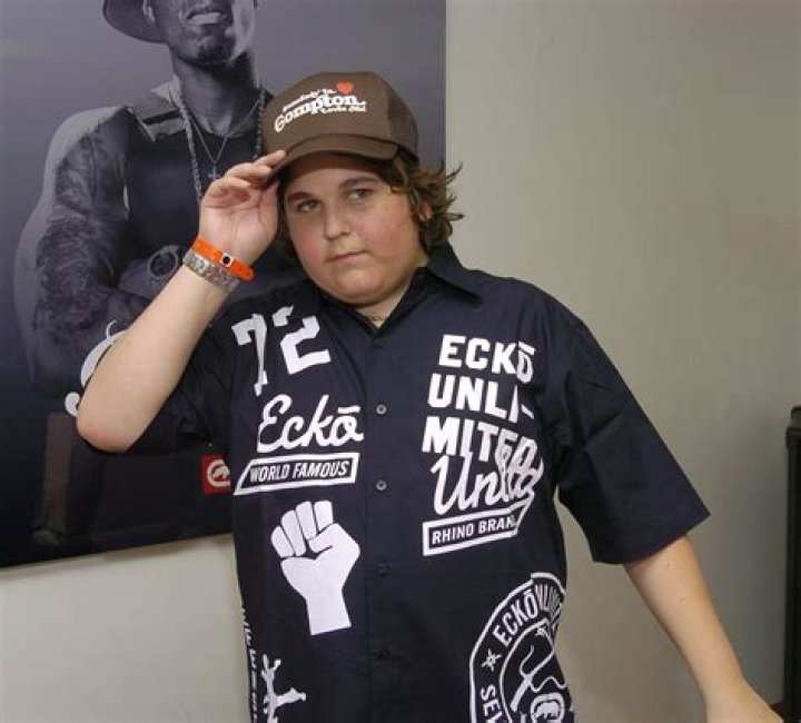 What Happened to Andy Milonakis? Does Andy Milonakis Have a Disease