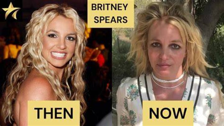 What Happened To Britney Spears' Teeth? Why Does She Have A Tooth Gap