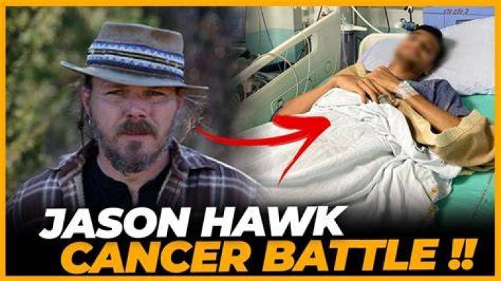 What happened to Jason Hawk (Mountain Men) face? Wiki Bio