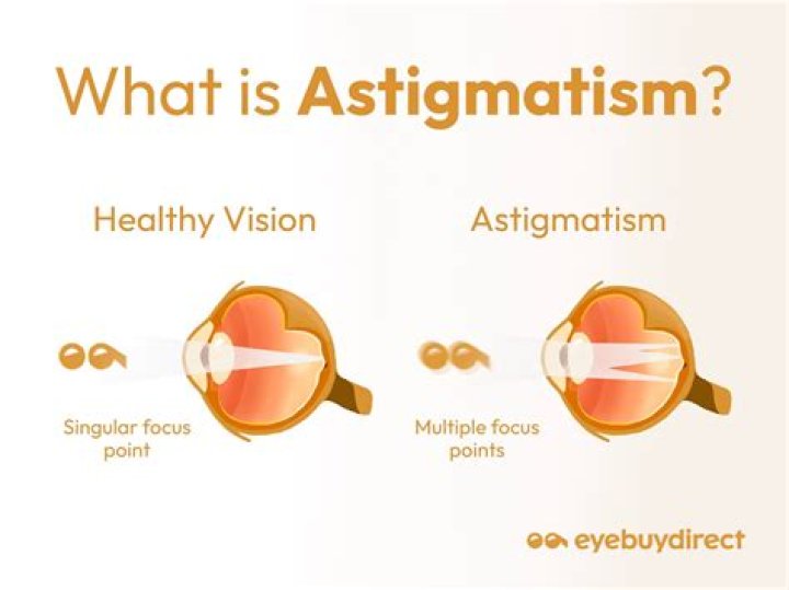 What is an Astigmatism in the Eye? Health Life Media
