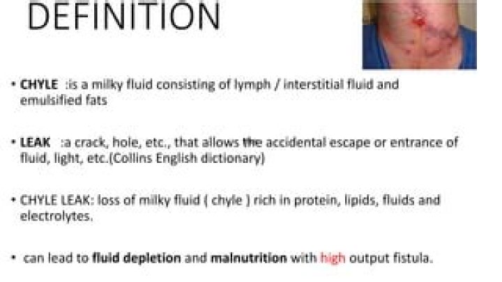 What is chyle leak? The Celeb Post