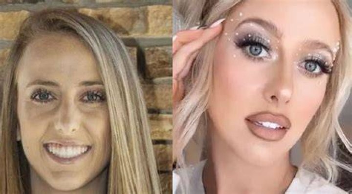 What Plastic Surgery Has Brittany Bristow Had Done? CelebritySurgeryIcon