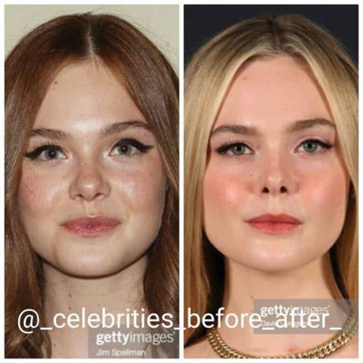 What Plastic Surgery has Elle Duncan gotten? Body Measurements, Boob
