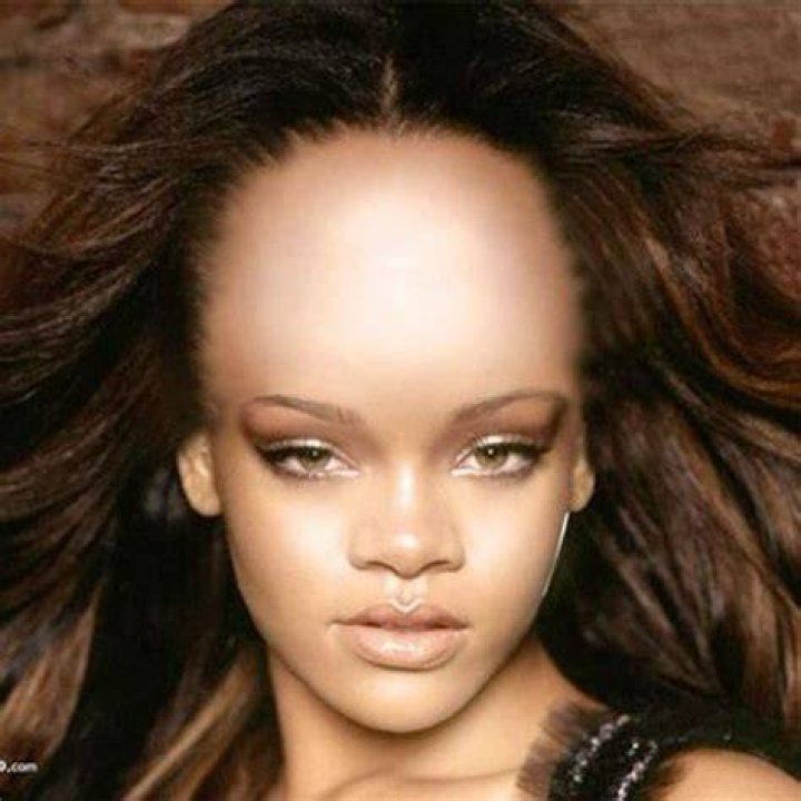 Who has the biggest forehead in the world? Everything you need to know
