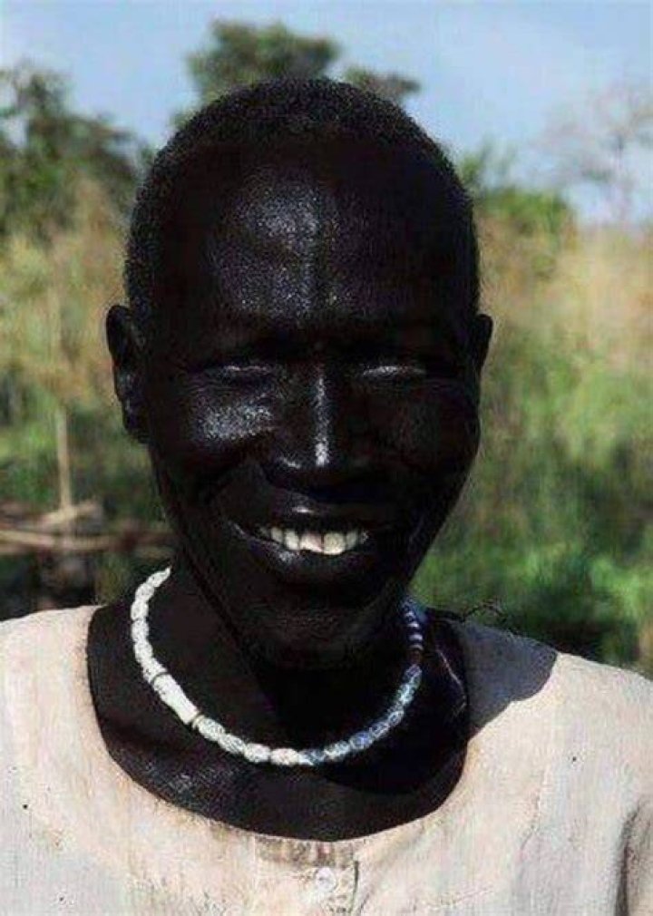 Who is the blackest person in the world, and is there a Guinness World
