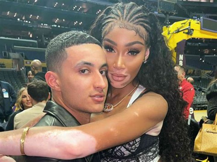 Winnie Harlow and Kyle Kuzma's Relationship Timeline TrendRadars