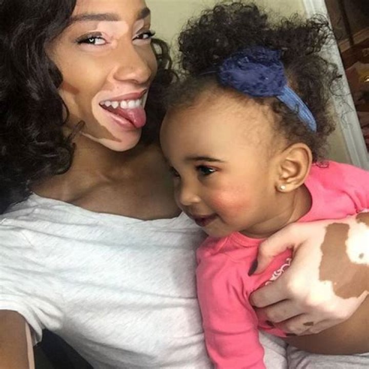 Winnie Harlow Instagram Best Moments Glamour UK
