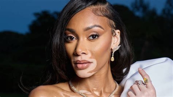 Winnie Harlow's changing the face of fashion CNN