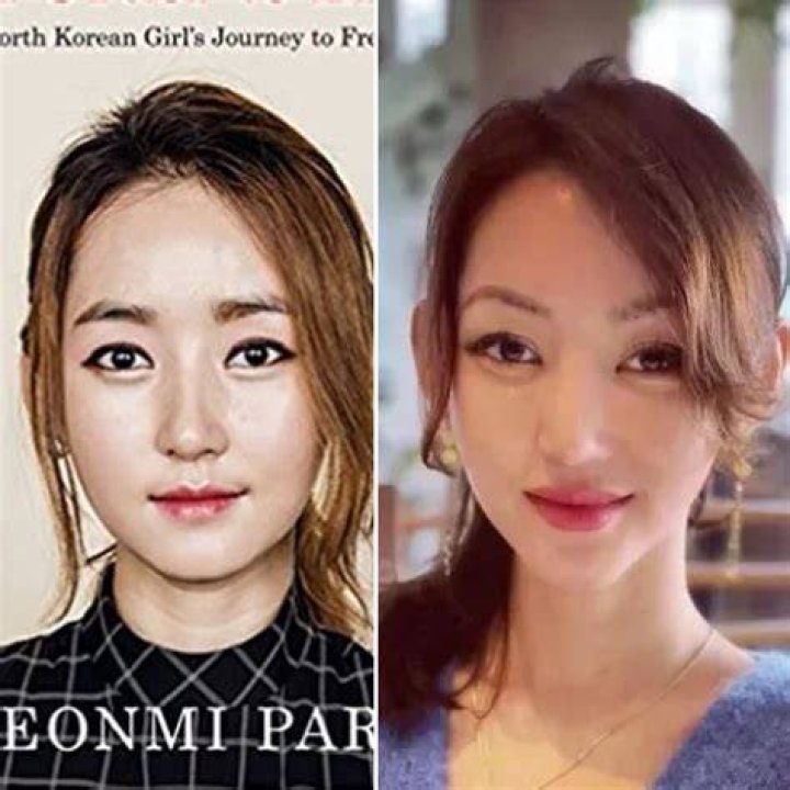 Yeonmi Park Plastic Surgery Before After Pics, Age And.