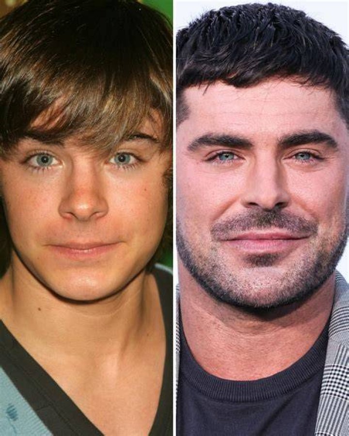 Zac Efron Before and After From 2004 to 2022 The Skincare Edit