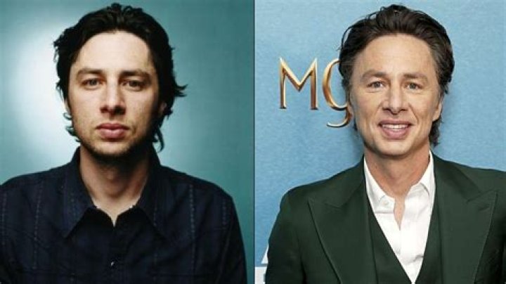 Zach Braff Plastic Surgery 2024 Before And After Photos