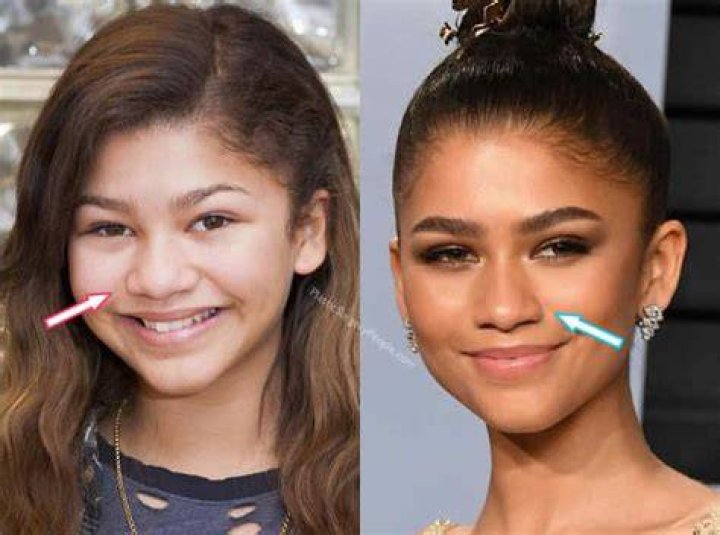 Zendaya BEFORE and AFTER 2022